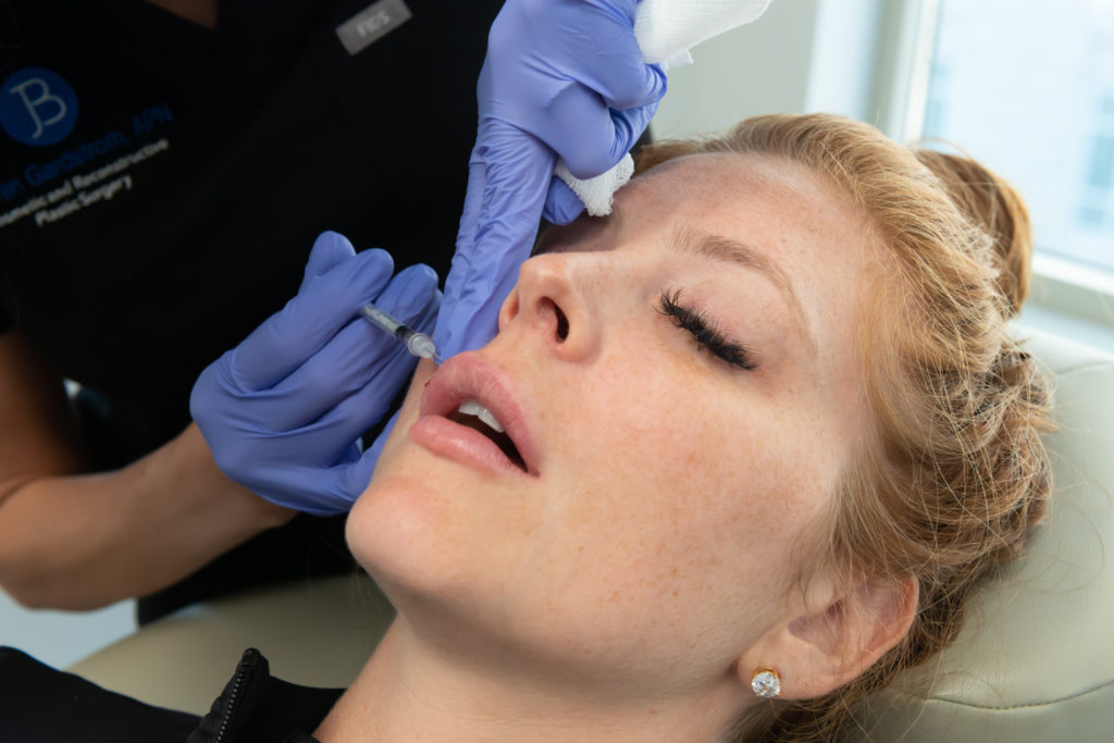 Dermal lip filler