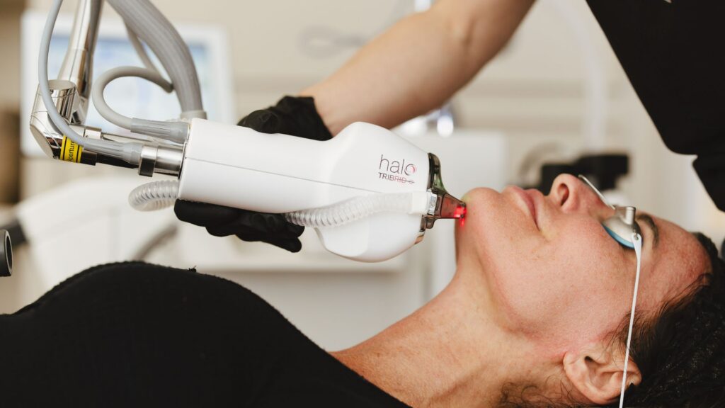 Patient receiving HALO laser skin resurfacing treatment to improve skin tone and texture