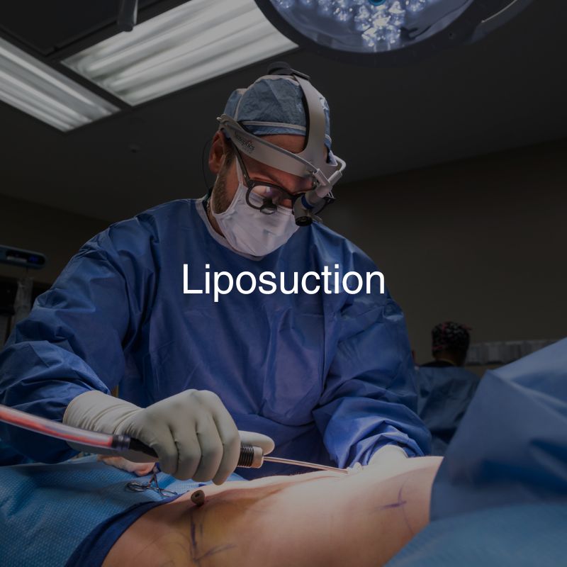 Liposuction